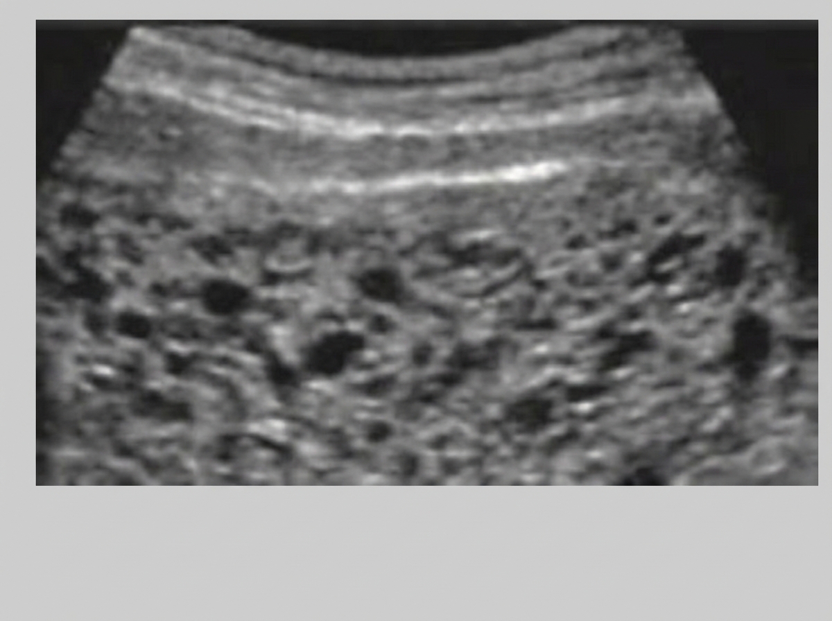 Image for question 62