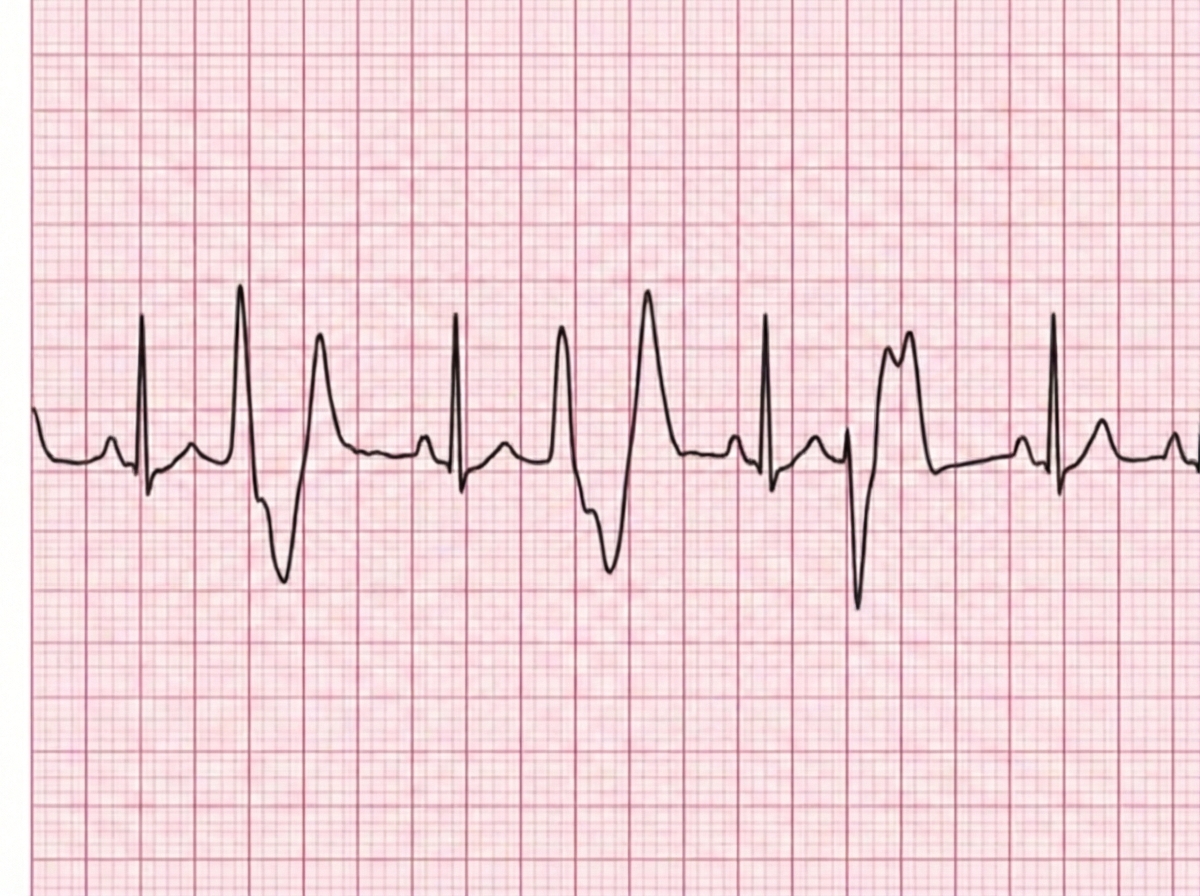 Image for question 728