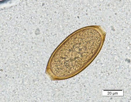 Image for question 94