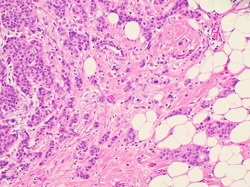 Image for question 604