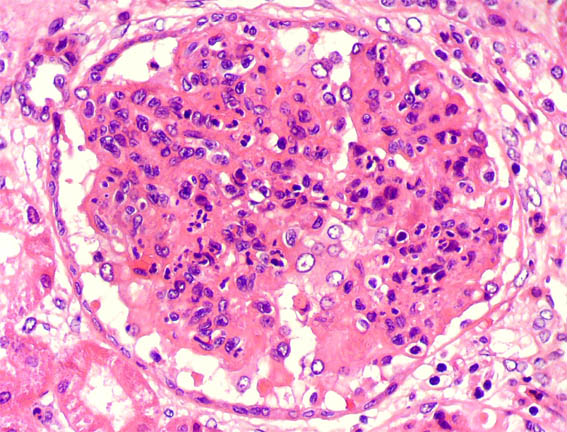 Image for question 112