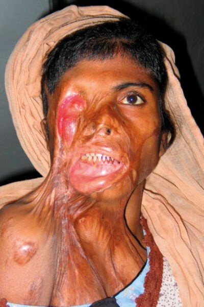 Image for question 166