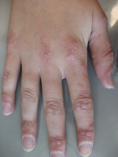 Image for question 639