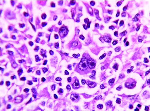 Image for question 523