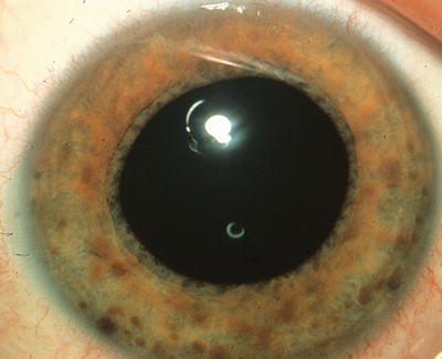 Image for question 253