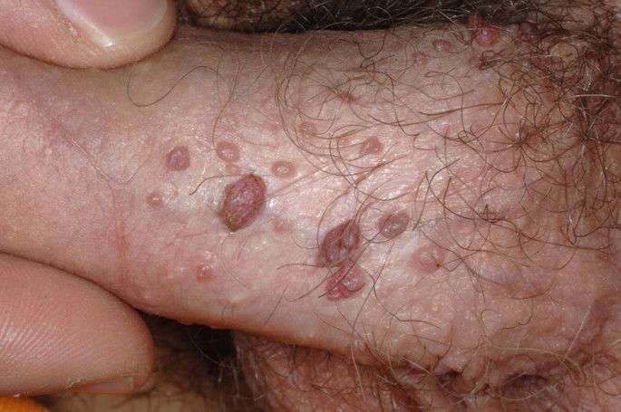 Image for question 1192