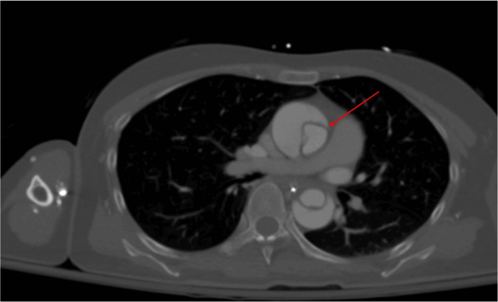 Image for question 14