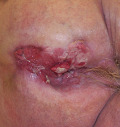 Image for question 875