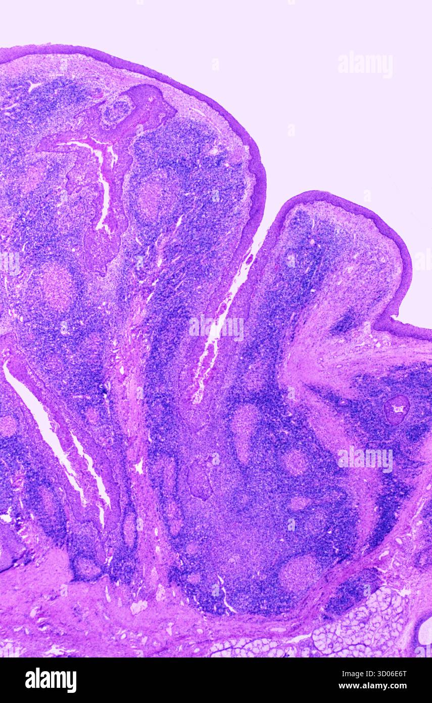 Image for question 395