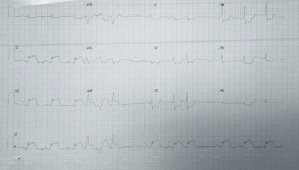 Image for question 1