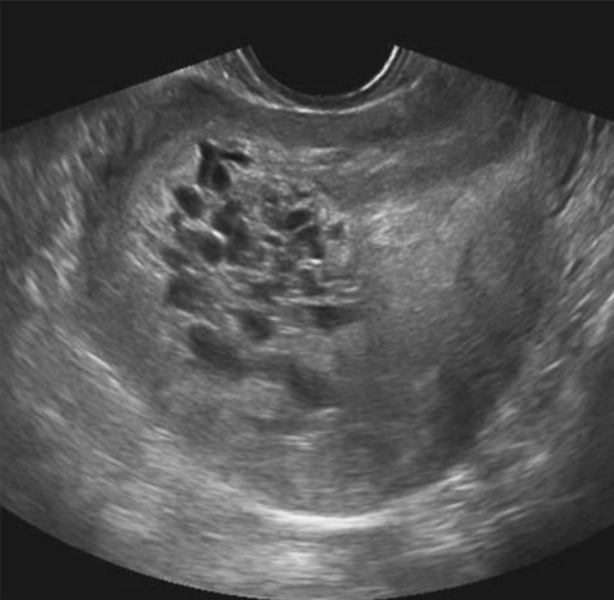 Image for question 78