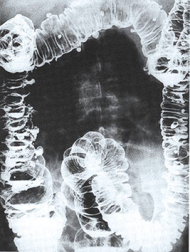 Image for question 406