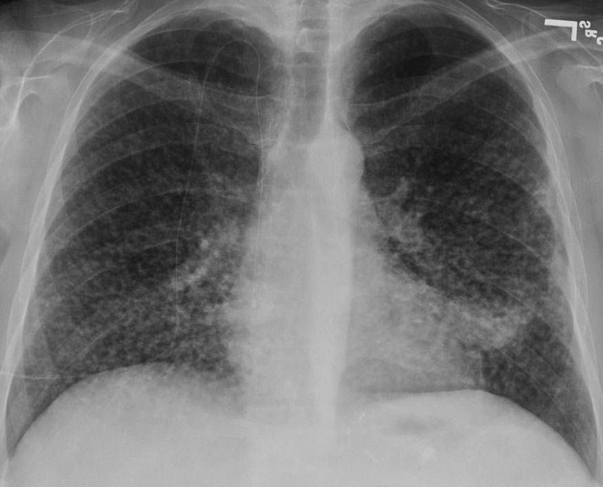 Image for question 254