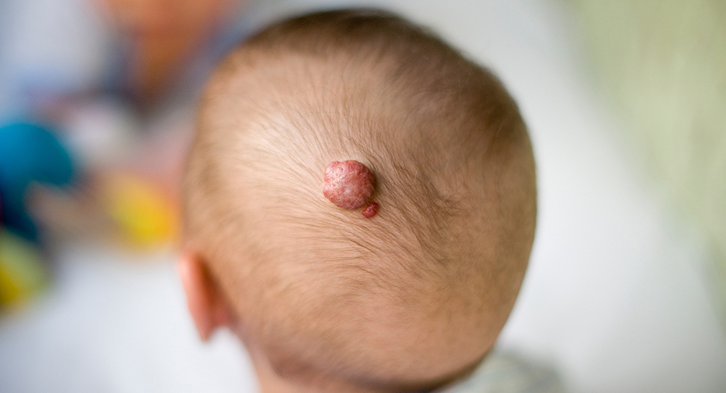 Image for question 104