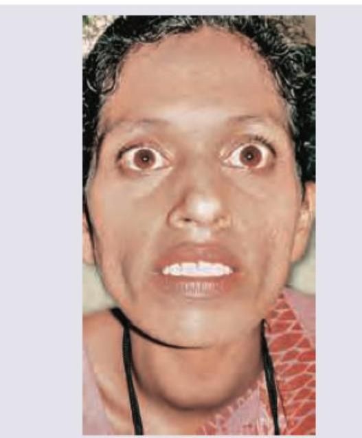 Image for question 935