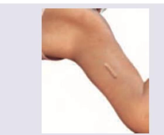 Image for question 299