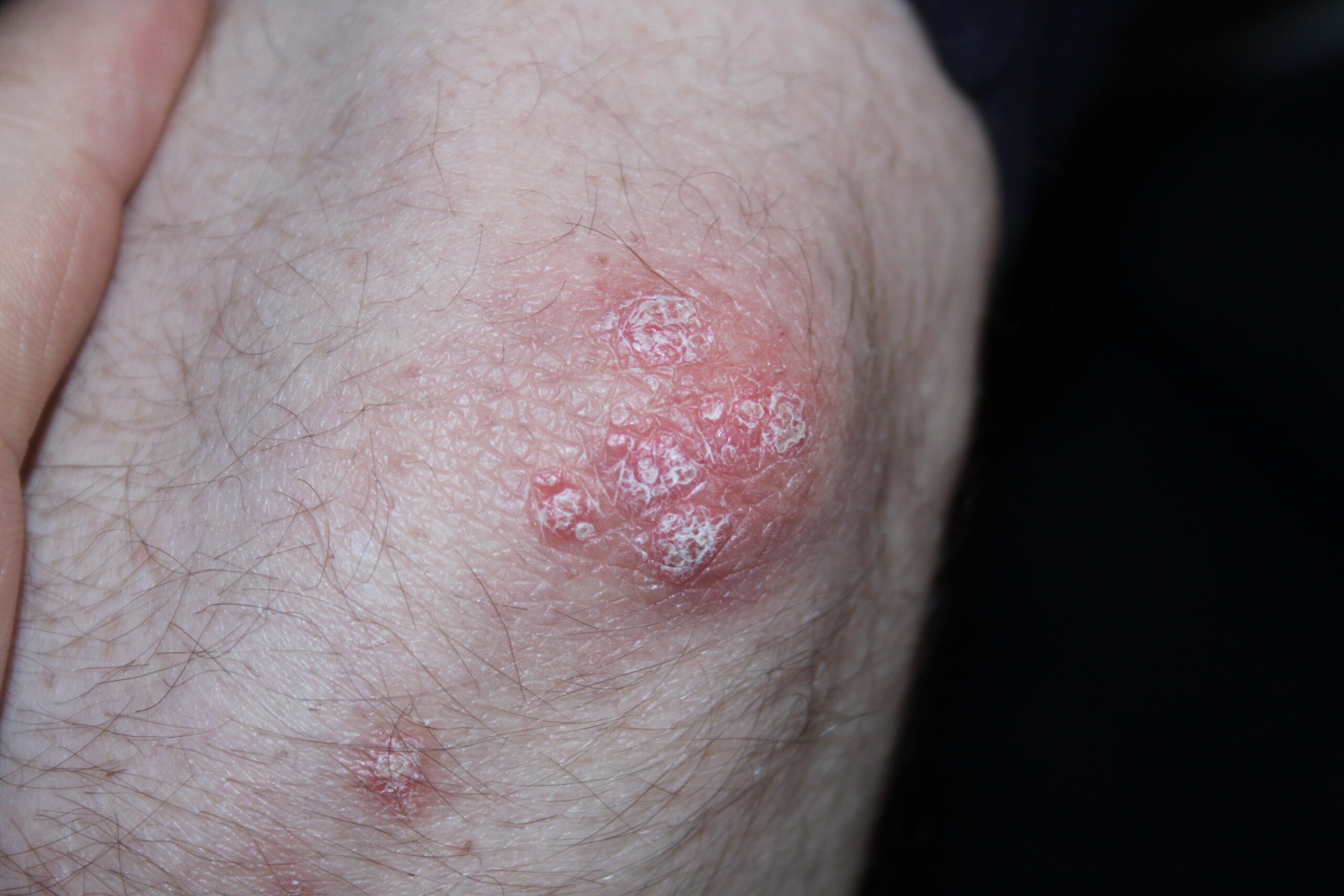 Image for question 61