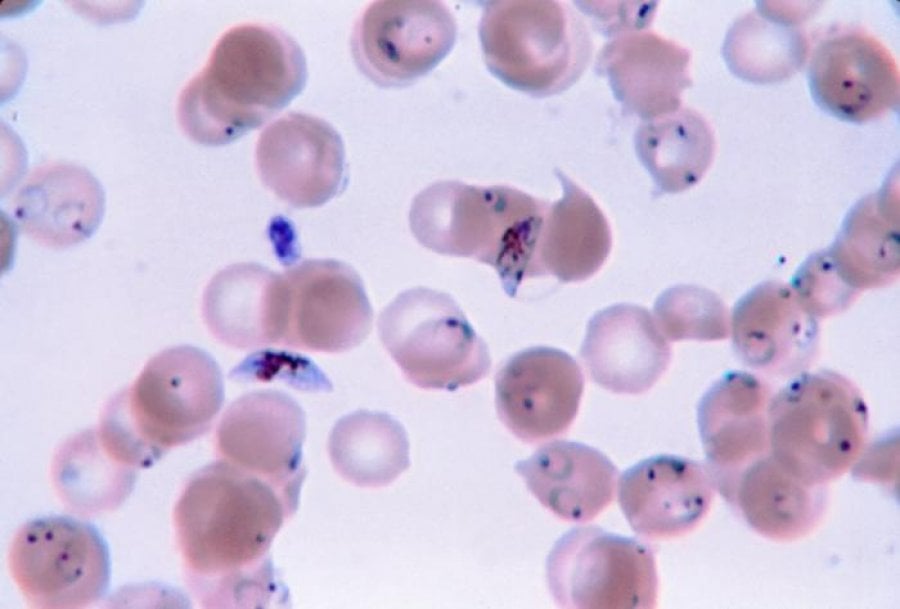 Image for question 15