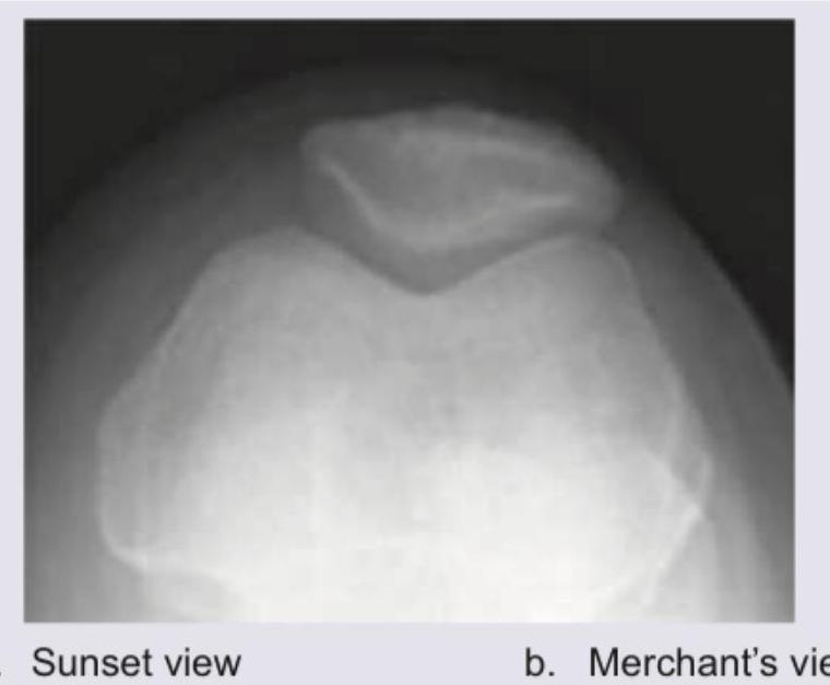 Image for question 65