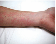 Image for question 37