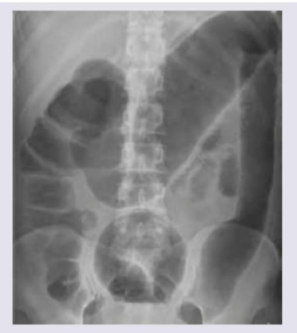 Image for question 17