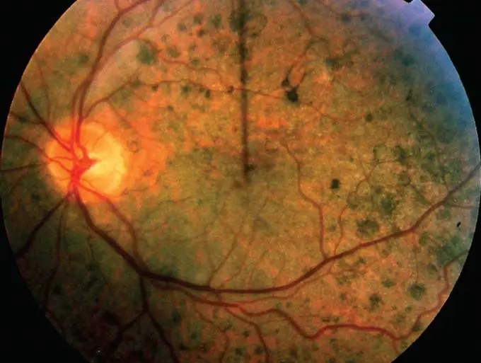 Image for question 1