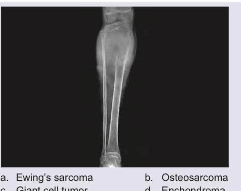 Image for question 243