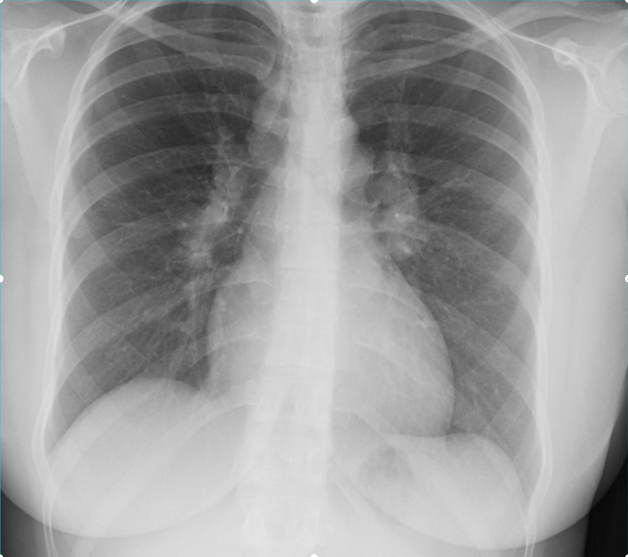 Image for question 522