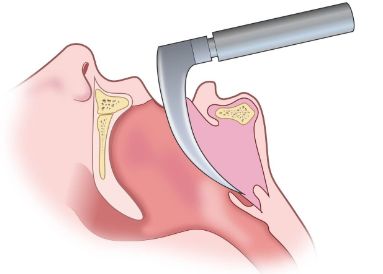 Image for question 135