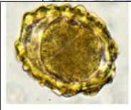 Image for question 243