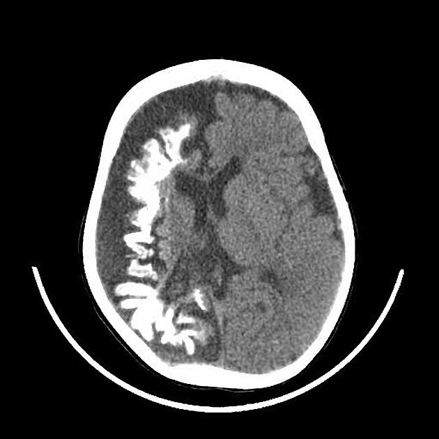 Image for question 142