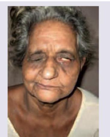 Image for question 1123