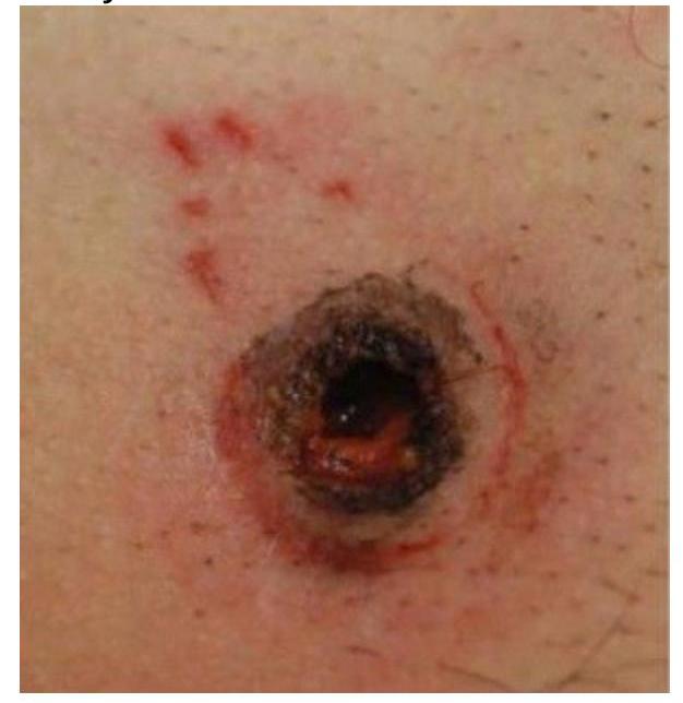 Image for question 175