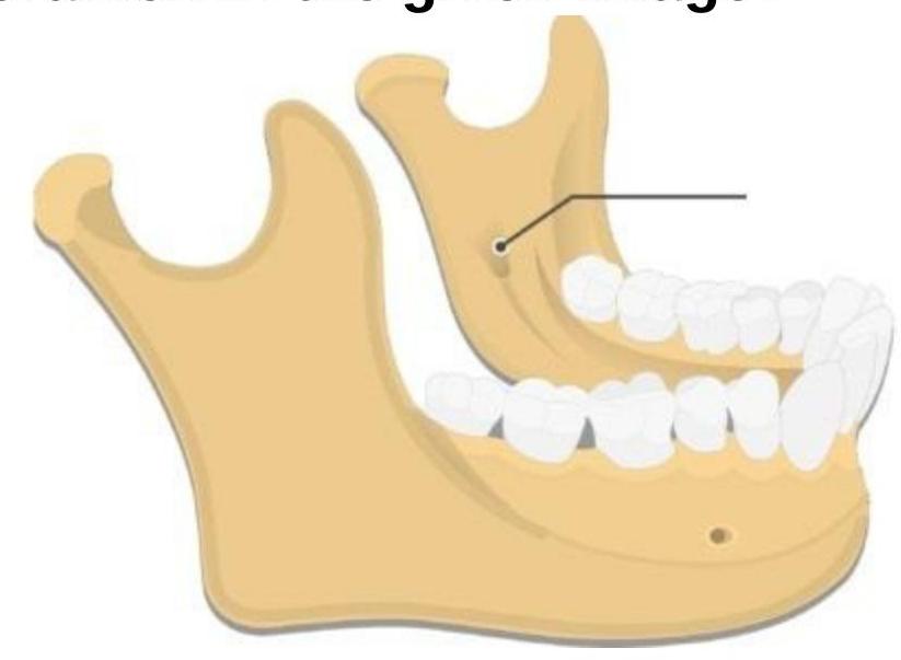 Image for question 100