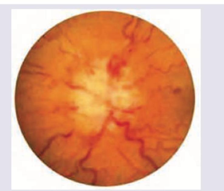 Image for question 868