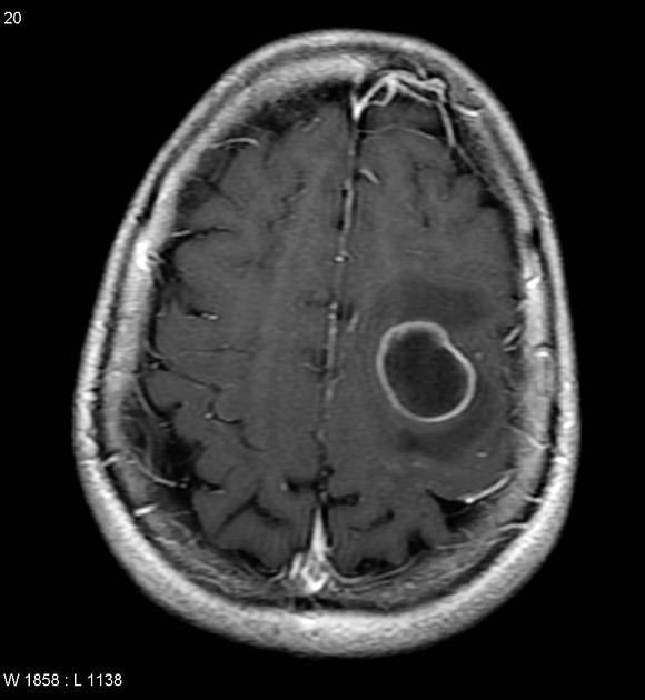 Image for question 117