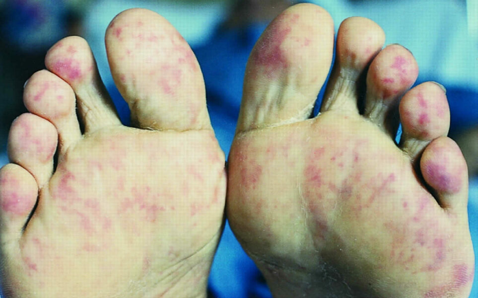 Image for question 1029