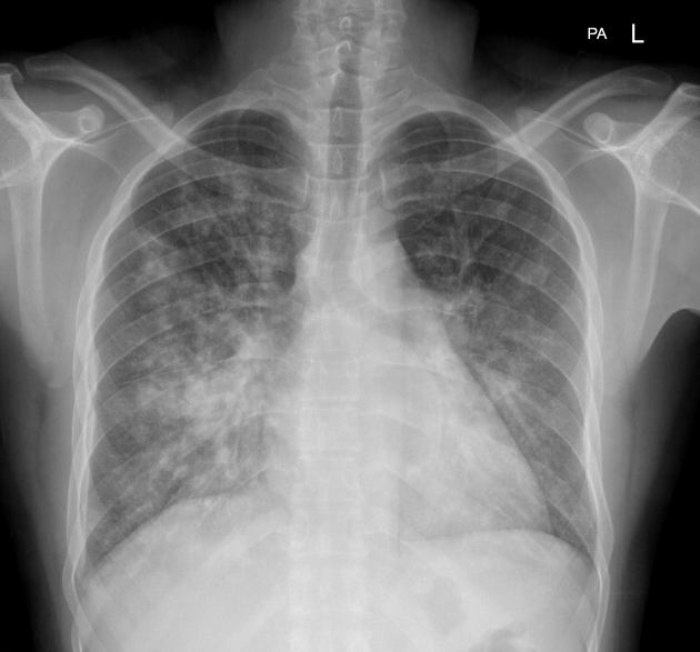 Image for question 396