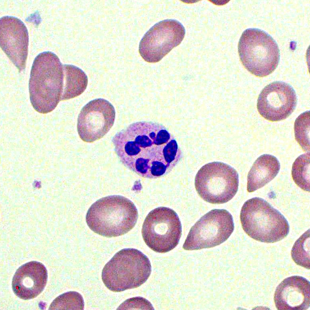 Image for question 393