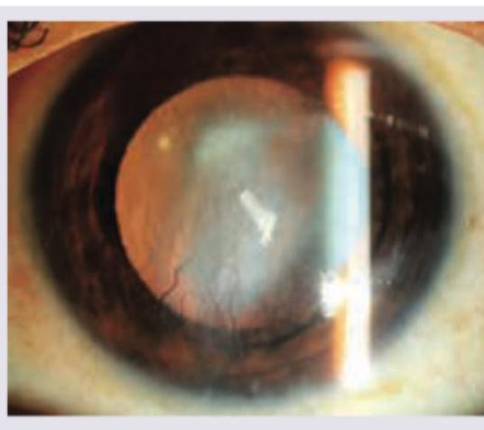 Image for question 125