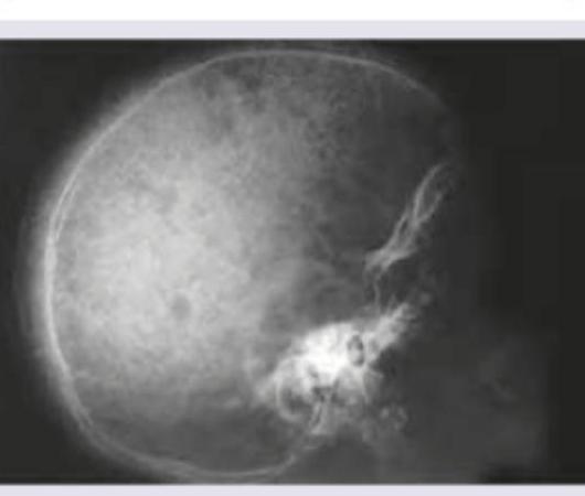 Image for question 551