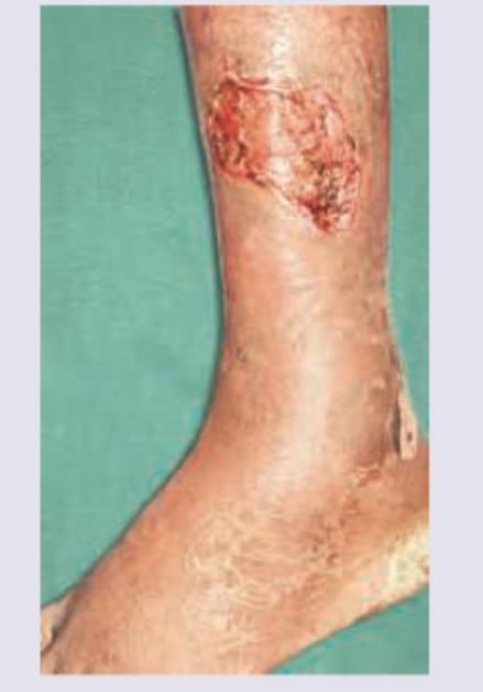 Image for question 129