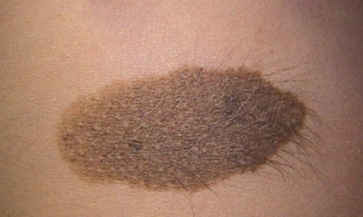 Image for question 228