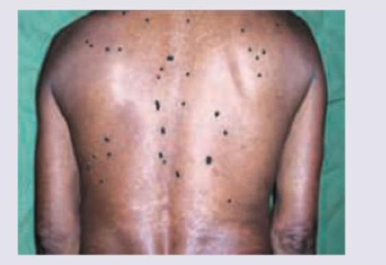 Image for question 205