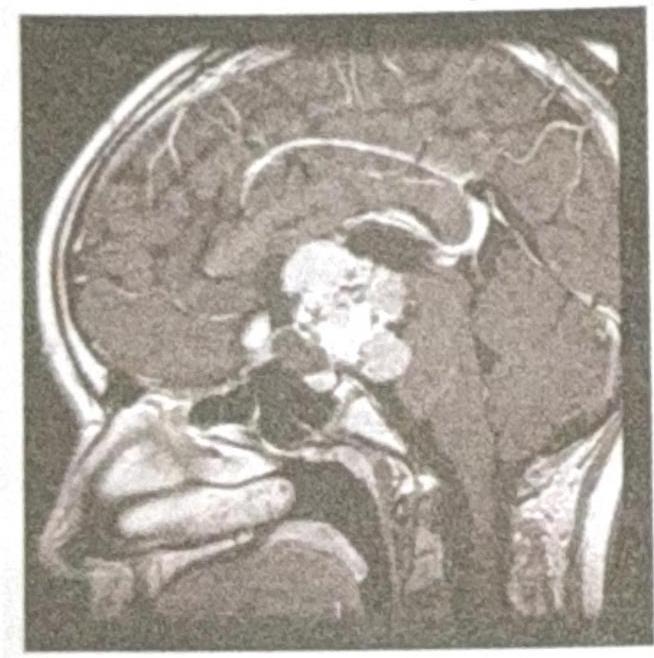 Image for question 186