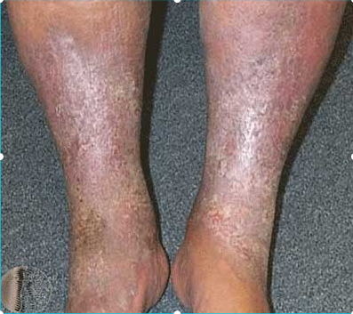 Image for question 11