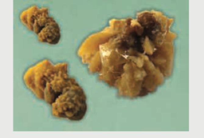 Image for question 117