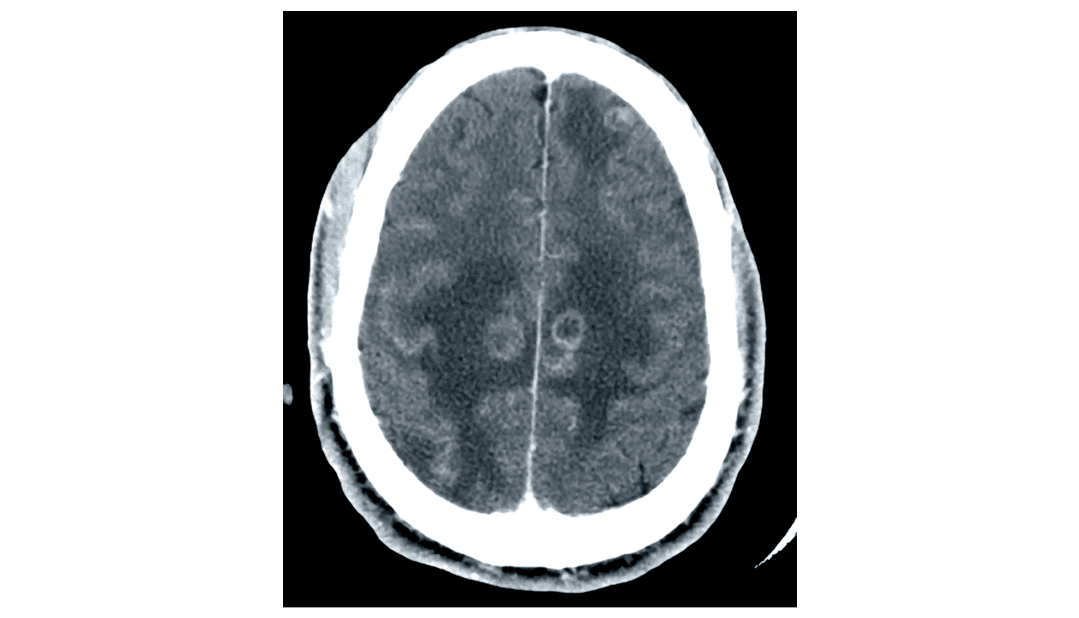 Image for question 226