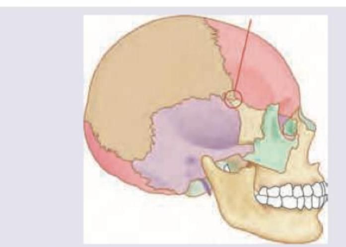 Image for question 312