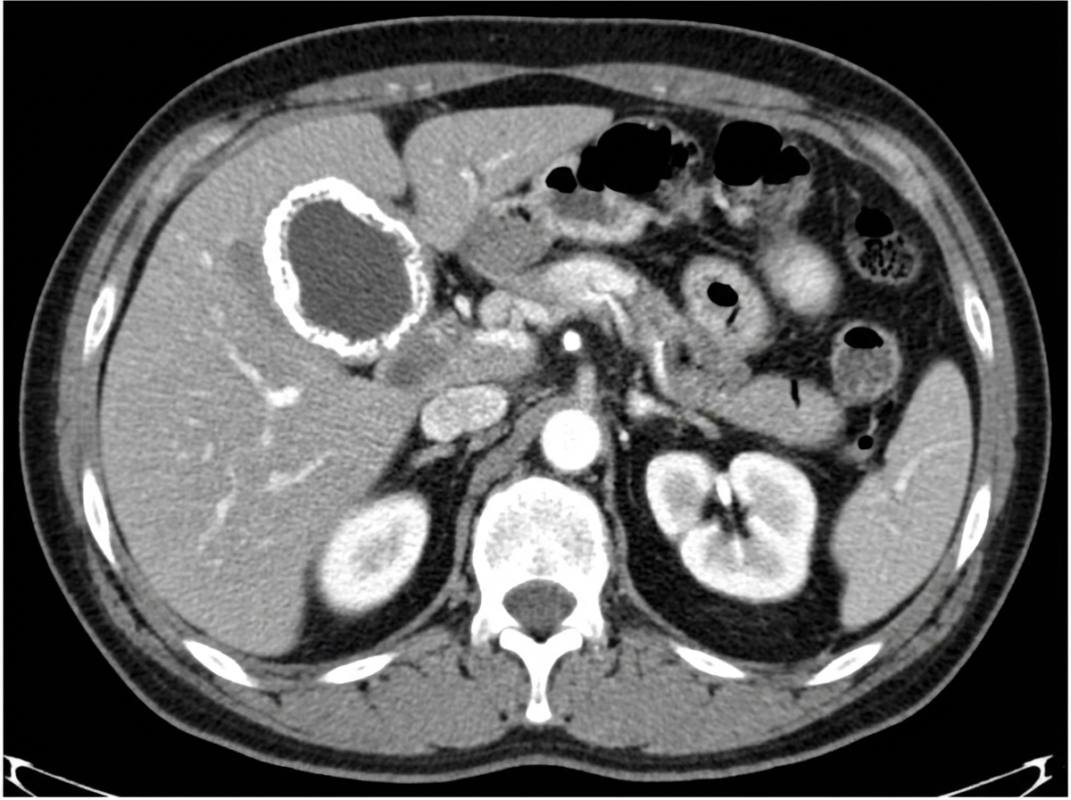 Image for question 172